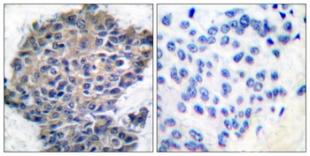 Filamin 1 (phospho Ser2152) rabbit pAb