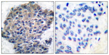 Filamin 1 (phospho-Ser2152) antibody