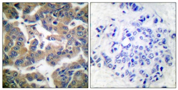 GR (phospho-Ser211) antibody