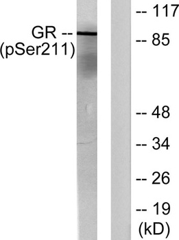 GR (phospho-Ser211) antibody