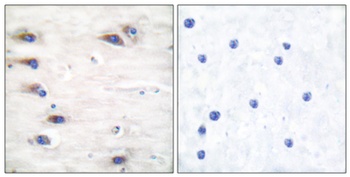 Ksr-1 (phospho Ser392) rabbit pAb