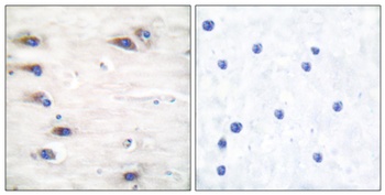 Ksr-1 (phospho-Ser392) antibody