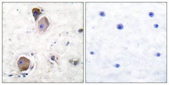 Lyn (phospho-Tyr508) antibody