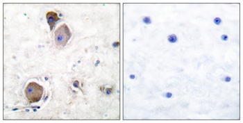 Lyn (phospho Tyr508) rabbit pAb