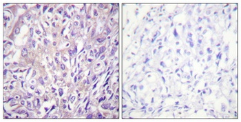 PLC β3 (phospho Ser1105) rabbit pAb