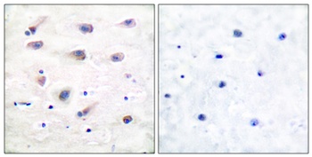 PLC β3 (phospho Ser1105) rabbit pAb