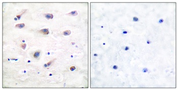 PLC beta3 (phospho-Ser1105) antibody