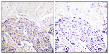 PLC γ1 (phospho Tyr771) rabbit pAb
