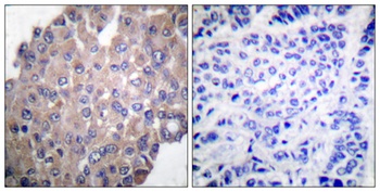 PLC γ1 (phospho Tyr771) rabbit pAb