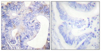 PLC gamma2 (phospho-Tyr753) antibody