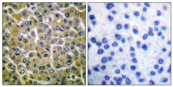 PLC γ2 (phospho Tyr753) rabbit pAb