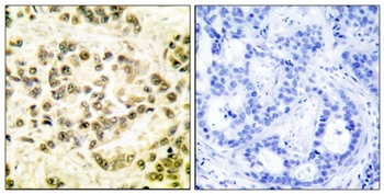 Stat5 (phospho Ser726/731) rabbit pAb