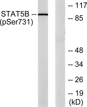 Stat5 (phospho Ser726/731) rabbit pAb