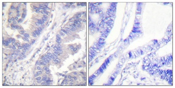 Syk (phospho Tyr348) rabbit pAb
