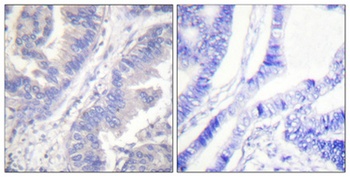 Syk (phospho-Tyr348) antibody