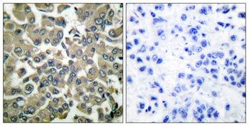 WNK1 (phospho Thr60) rabbit pAb