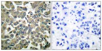 WNK1 (phospho-Thr60) antibody