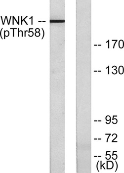 WNK1 (phospho Thr60) rabbit pAb