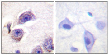 FAK (phospho Tyr407) rabbit pAb