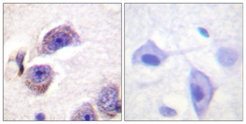 FAK (phospho-Tyr407) antibody