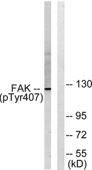 FAK (phospho Tyr407) rabbit pAb