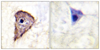Flt-1 (phospho Tyr1333) rabbit pAb