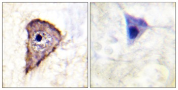 Flt-1 (phospho-Tyr1333) antibody