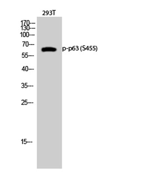 p63 (phospho-Ser455) antibody