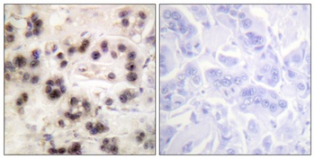 p63 (phospho Ser455) rabbit pAb