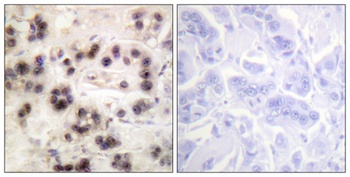 p63 (phospho-Ser455) antibody