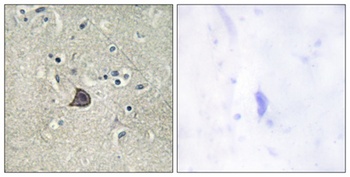 PLC β3 (phospho Ser537) rabbit pAb