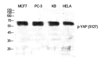 YAP (phospho-Ser127) antibody
