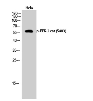 PFK-2 car (phospho Ser483) rabbit pAb