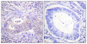 PFK-2 car (phospho Ser483) rabbit pAb