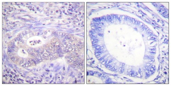 PFK-2 car (phospho-Ser483) antibody