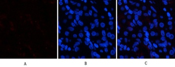 p38 (phospho-Tyr323) antibody