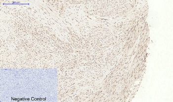 p38 (phospho Tyr323) rabbit pAb