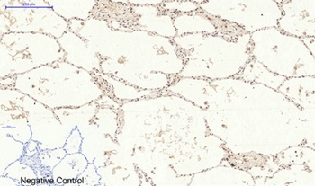 p38 (phospho-Tyr323) antibody
