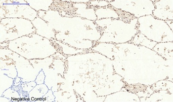 p38 (phospho Tyr323) rabbit pAb