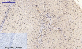 FAK (phospho Tyr397) rabbit pAb