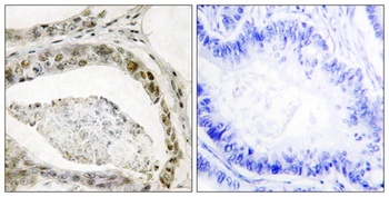 Smad3 (phospho Ser208) rabbit pAb