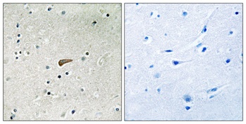 FRS2 (phospho-Tyr436) antibody