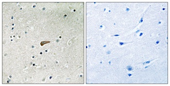 FRS2 (phospho Tyr436) rabbit pAb