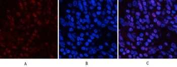 JNK1/2/3 (phospho Tyr185) rabbit pAb
