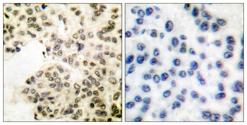 NFκB-p65 (phospho Ser311) rabbit pAb