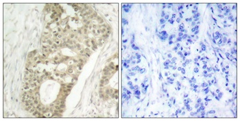 PKC delta (phospho-Ser645) antibody