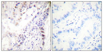 CREB-1 (phospho Ser142) rabbit pAb
