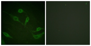 Cytokeratin 18 (phospho Ser33) rabbit pAb