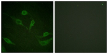 Cytokeratin 18 (phospho-Ser33) antibody