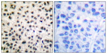 MEF-2 (phospho Ser408) rabbit pAb